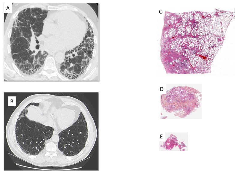 Art 2 Borie figure lettre de linternat 3