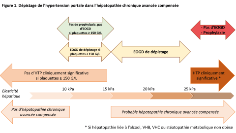 Dépistage de l'hypertension portale dans l'hépatopathie chronique avancée compensée.