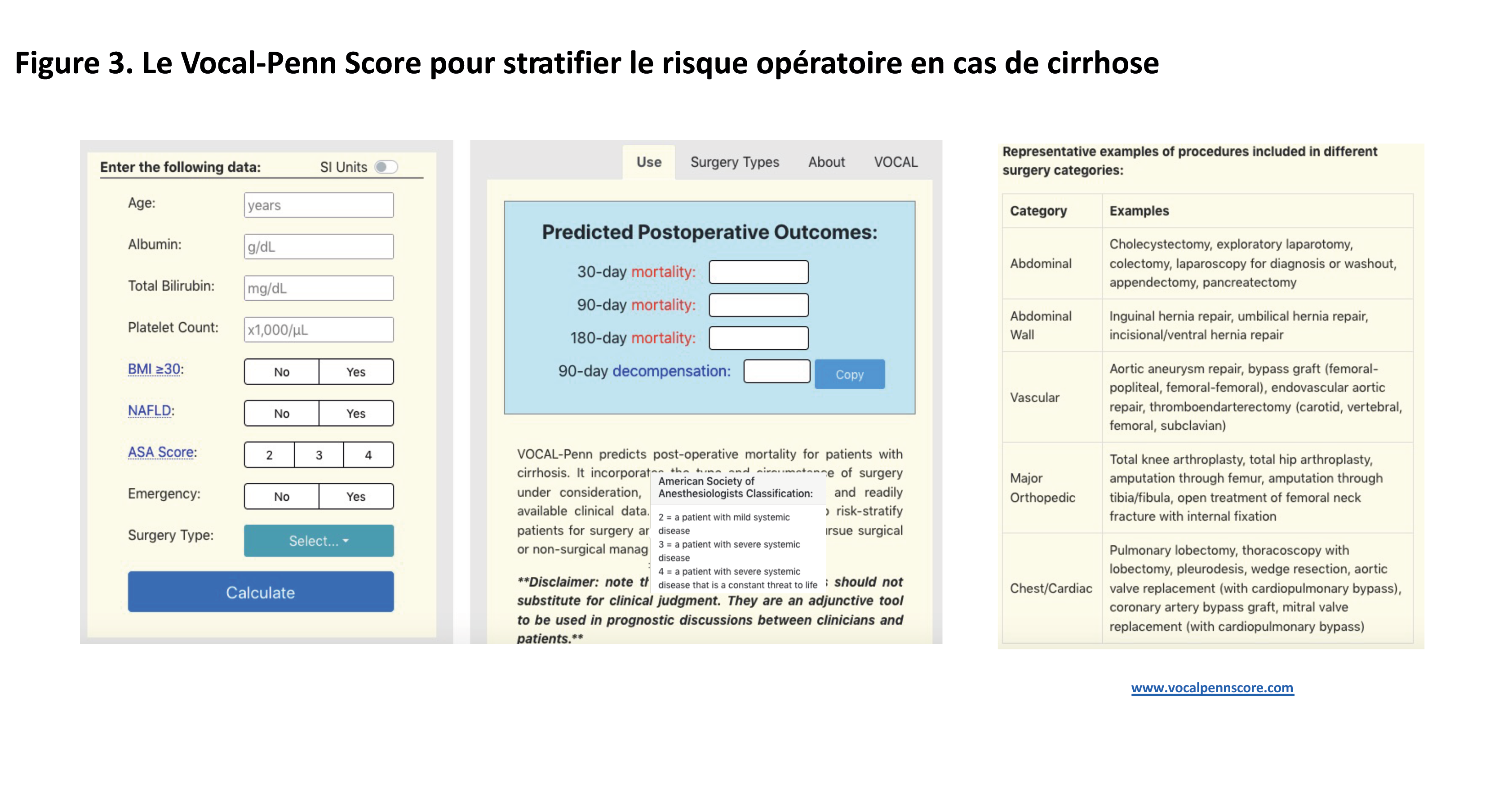 L'hypertension portale