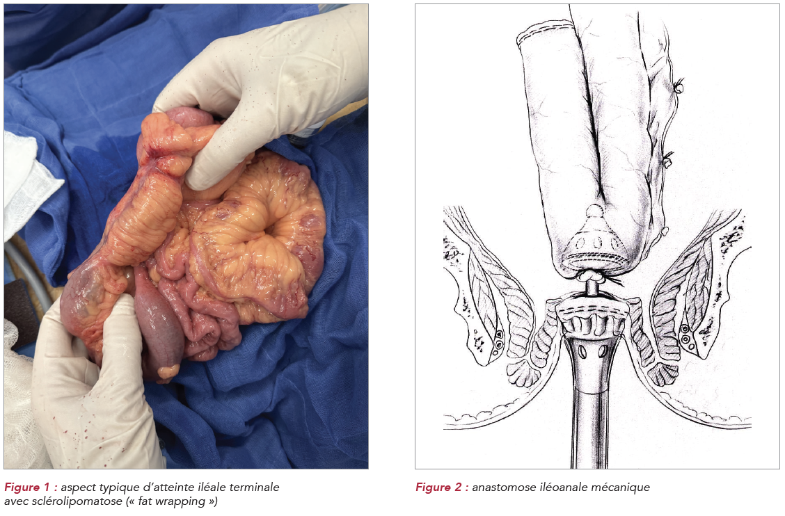 Capture d'écran 2025 04 30 à 11 36 26