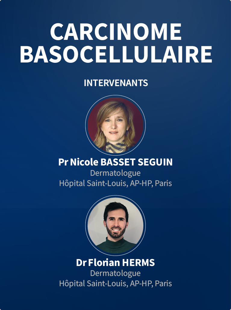 CARCINOME BASOCELLULAIRE