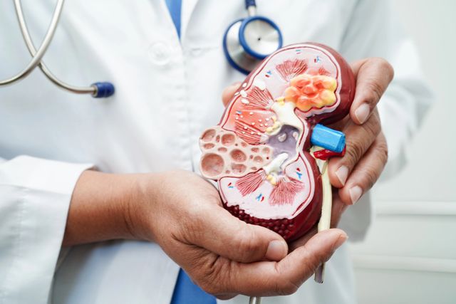 Edito du dossier Lithiase urinaire