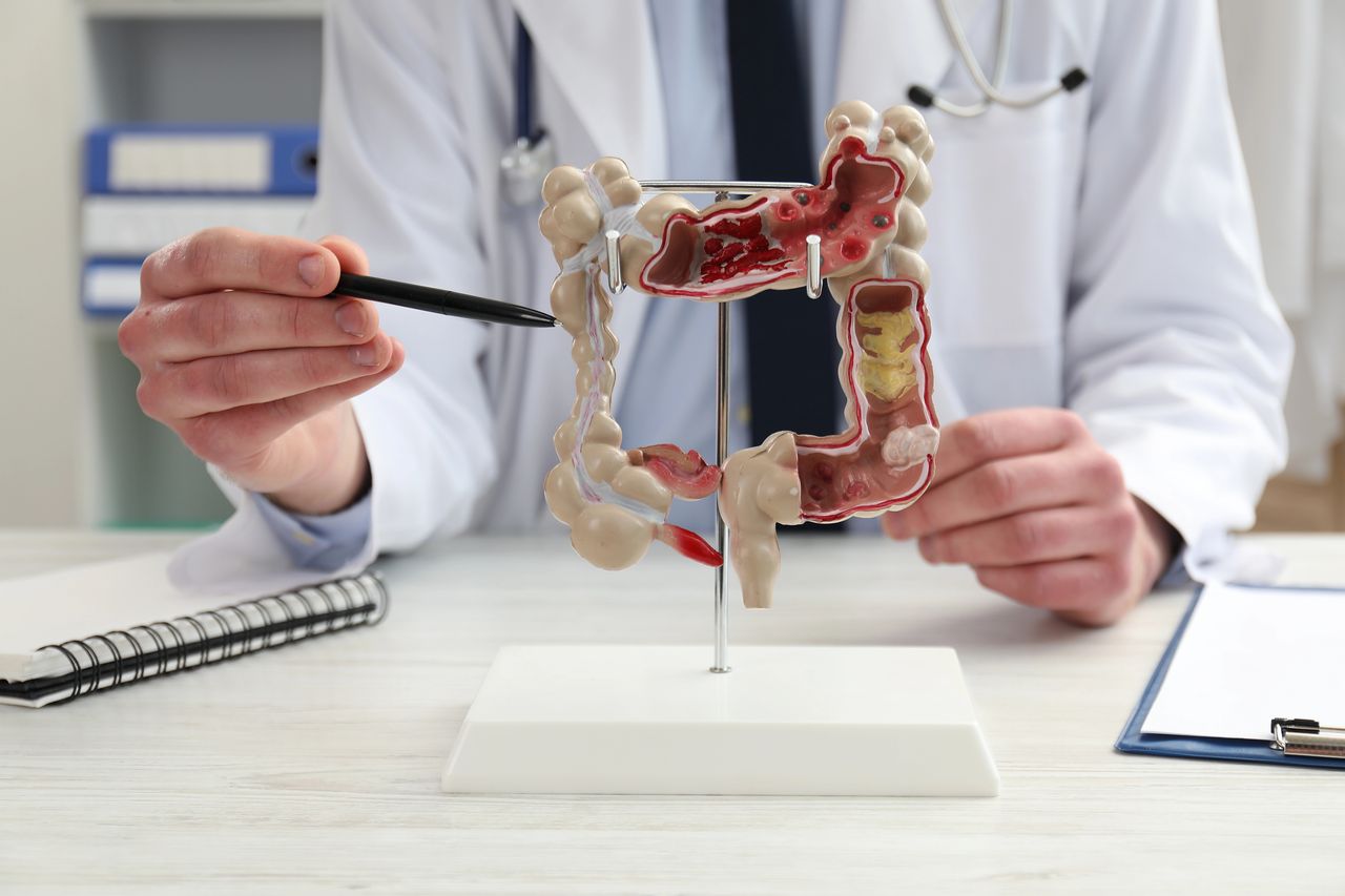 Illustration medicale - NOUVEAUX OUTILS ET ENJEUX POUR LE MONITORING DES MICI