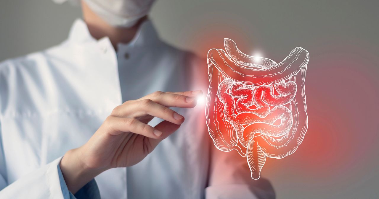 Illustration medicale - PRISE EN CHARGE MODERNE DE LA MALADIE DE CROHN