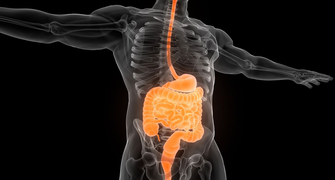 Illustration medicale - MANIFESTATIONS EXTRA-INTESTINALES