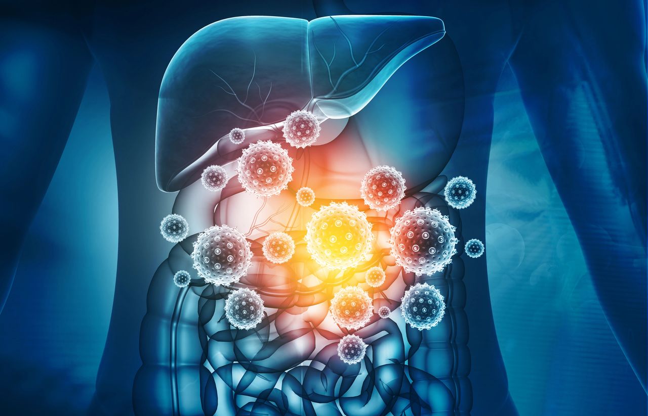 Illustration medicale - Toxicité digestive des immunothérapies anti-cancéreuses